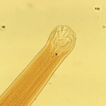 Canadian Couple Brings Back Unwanted Souvenirs From Caribbean Vacation … Hookworms in Their Feet!