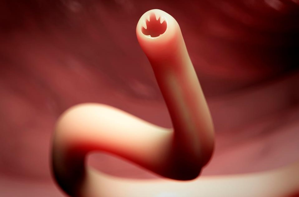 BITING WORMS: British Couple Sits on the Beach In Martinique and Gets Hookworm In Their Behinds