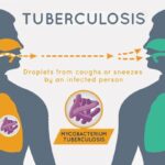 Inmate At St. Thomas Jail Tests Positive For Tuberculosis On Monday, BOC Says