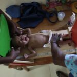 Lack of funding forces UN to slash food program in Haiti amid a surge in malnutrition