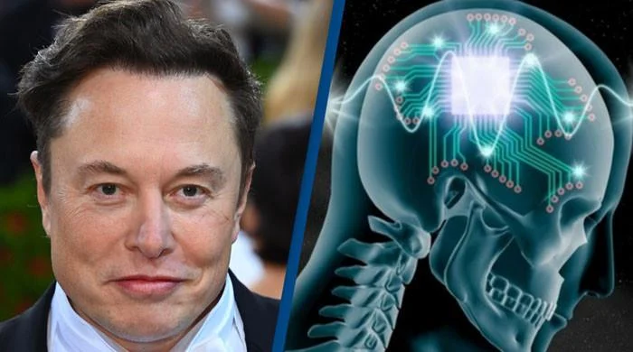 Musk Says Neuralink Installs Brain Implant In First Patient