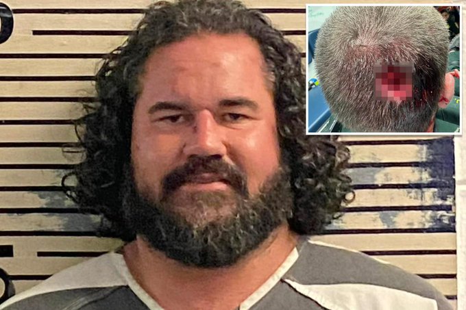 Drugged-out Florida wacko who bit off chunk of flesh from cop’s skull at music festival sentenced for horrific attack
