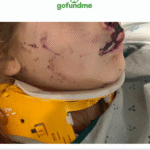 Sleeping 9-year-old nearly killed when driver plows into bedroom