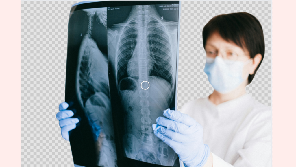 Can Asbestos Cause Immediate Symptoms?